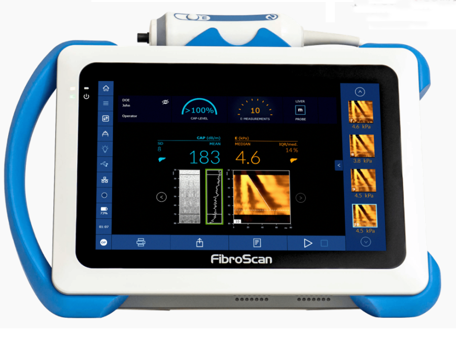 Fibroscan Machine